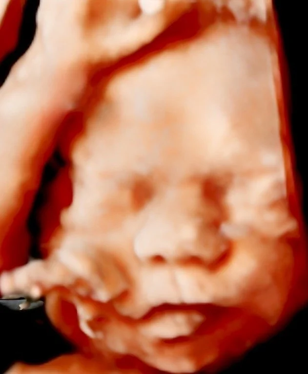3D/4D/5D Ultrasound