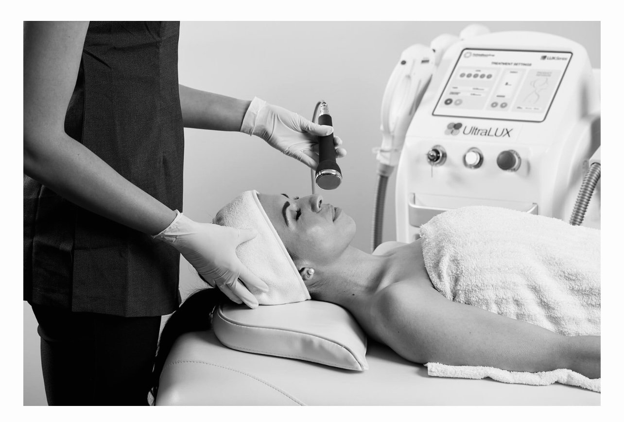 IPL Facial Treatments