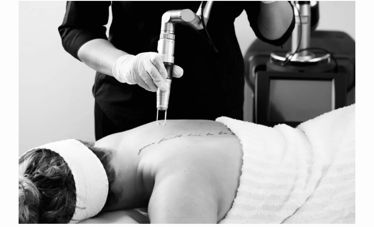 Medical professional using a tattoo removal laser on a person's back in a clinical setting, with the person lying face down.
