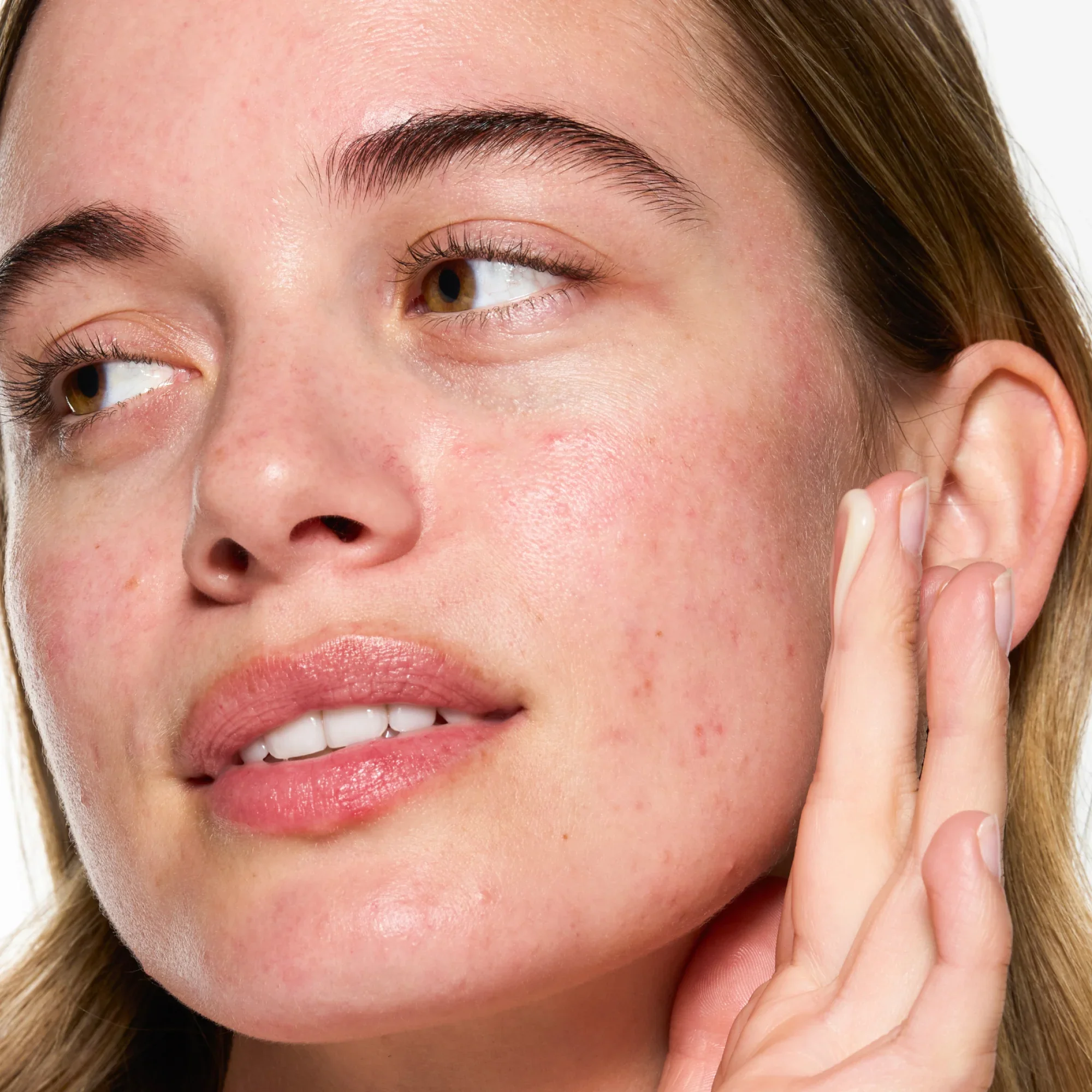 hyperpigmentation facial.webp