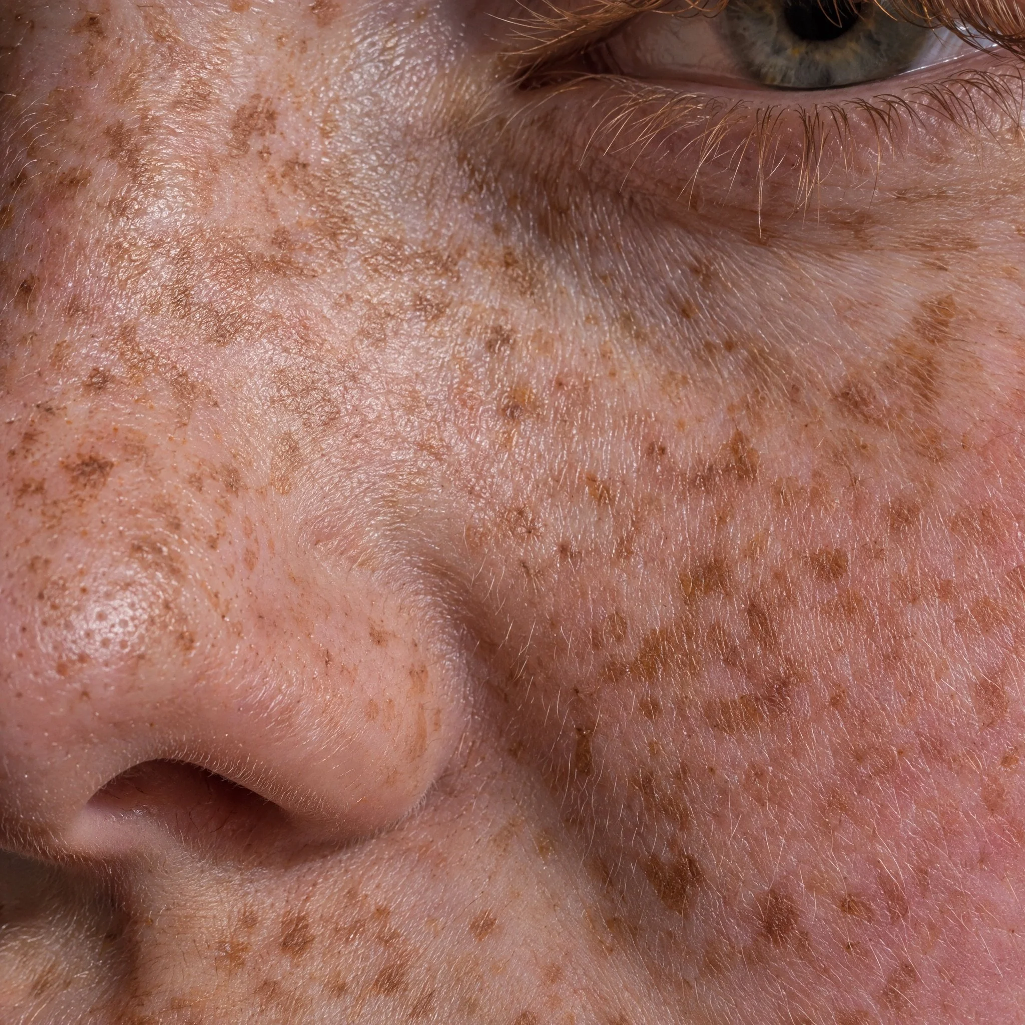 Extreme macro of freckled skin across a nose and cheek.