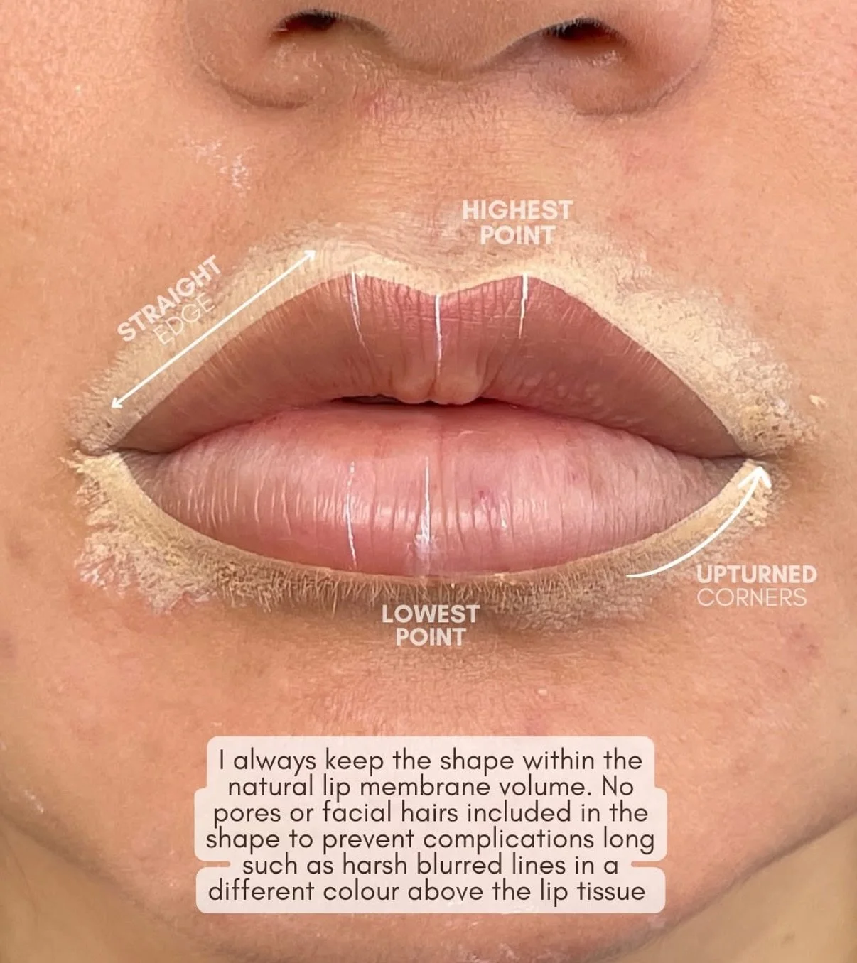 Lip Blush is all about working with your natural lip shape 👄

The pigment is placed within the natural lip membrane to enhance colour, refine shape and create a soft, balanced finish. This ensures the result heals beautifully and avoids harsh lines 
