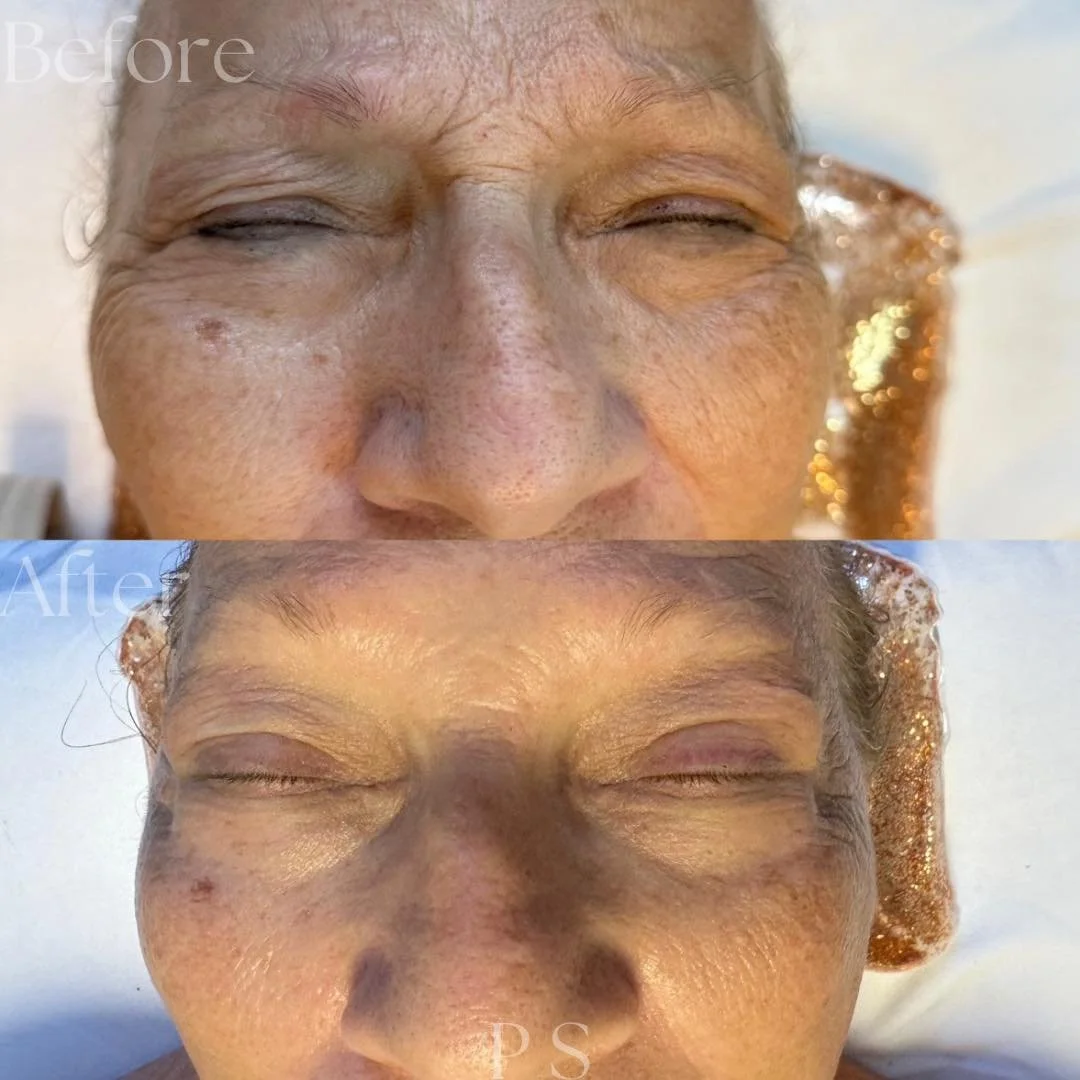 beforeafter5.jpg