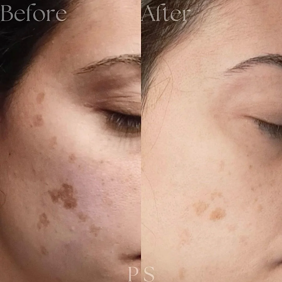 beforeafter3.jpg