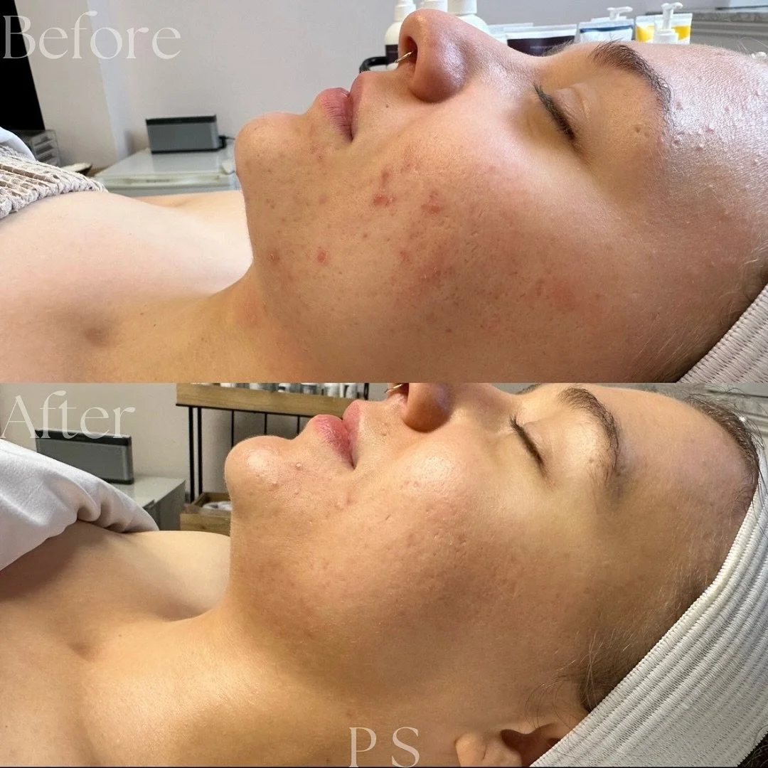 beforeafter2.jpg