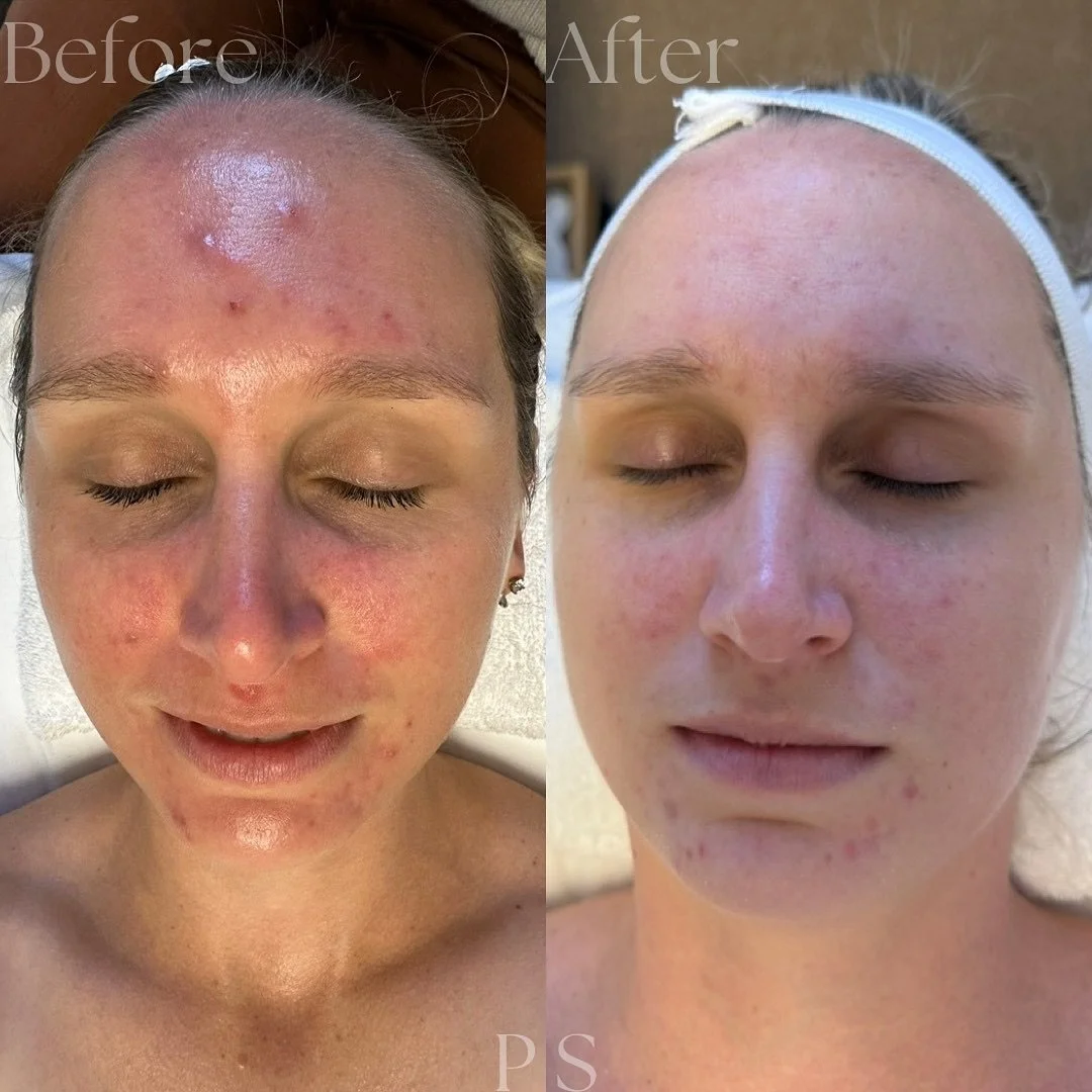 beforeafter1.jpg