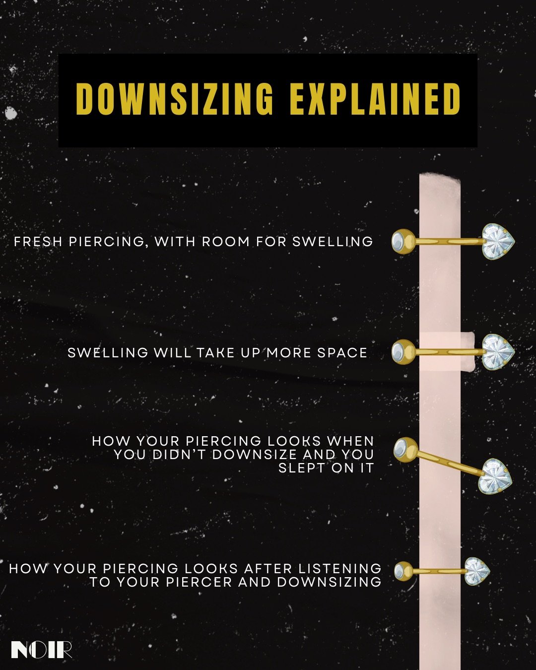 Is your piercing still irritated, grumpy, or acting like it wants to fight you? 
There&rsquo;s a big chance it just needs&hellip; a downsize.

When we pierce you, we intentionally use a longer bar to give your body room to swell. 
But once that swell