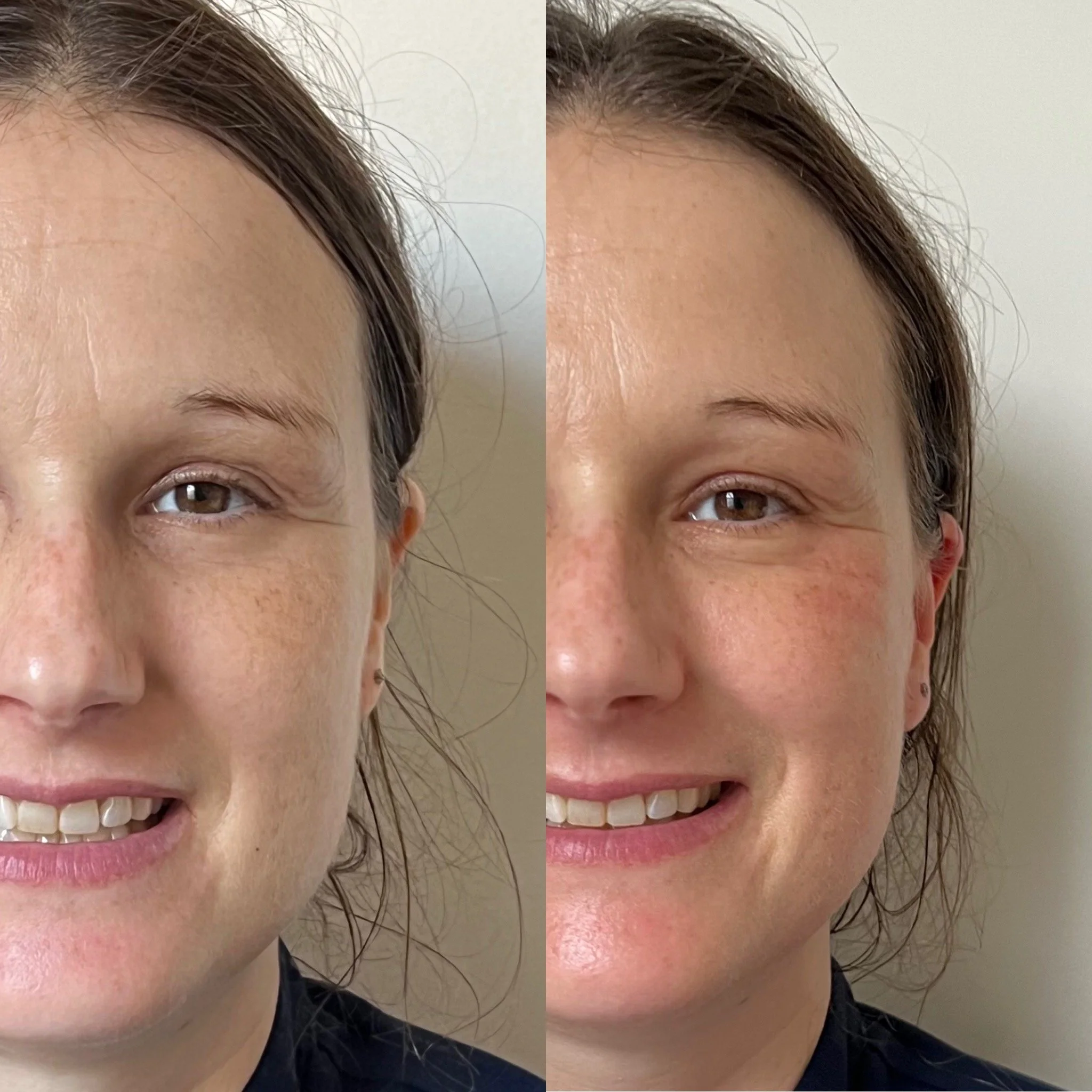Face Neck & Scalp Massage