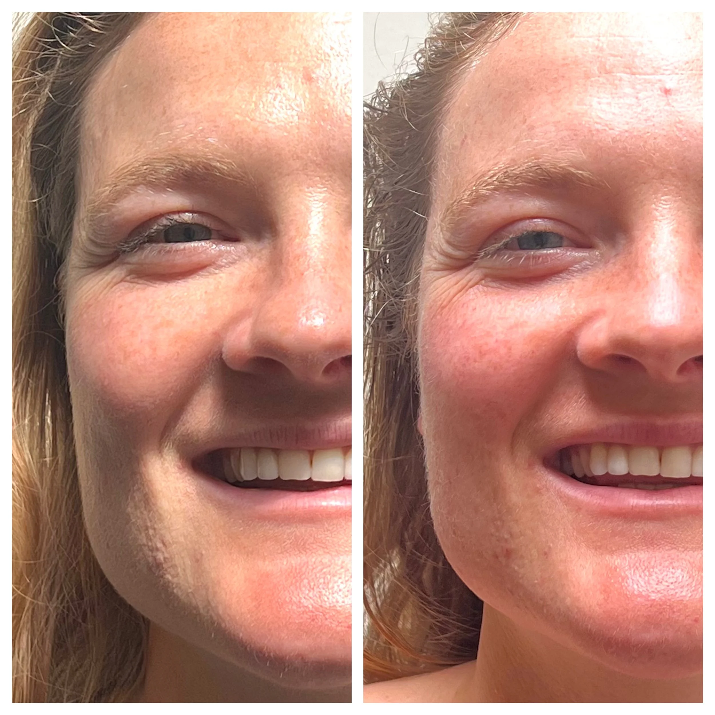 organic holistic facial Neals Yard Remedies