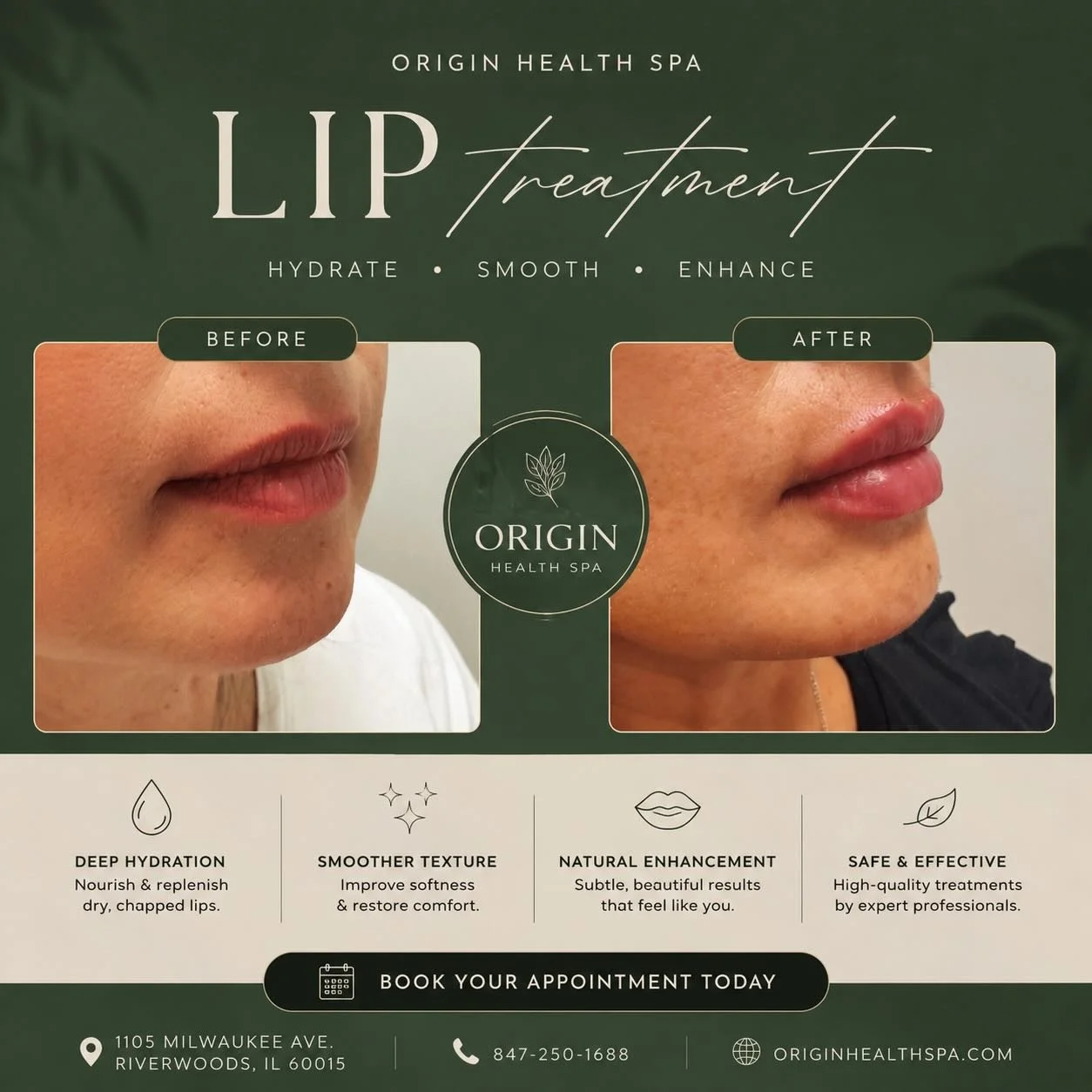 ✨ Naturally enhanced. Beautifully balanced. ✨

At Origin Health Spa￼, we believe lip treatments should enhance your natural beauty &mdash; never overpower it.

This subtle lip enhancement adds hydration, shape, and softness while keeping a natural, e