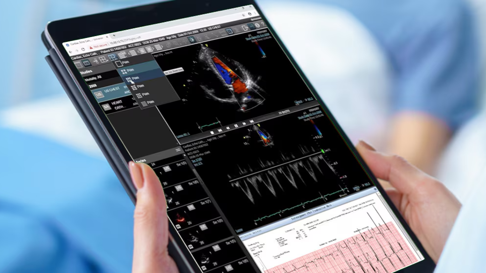 A medical professional holding a tablet displaying an echocardiogram with color Doppler imaging and ECG readings.