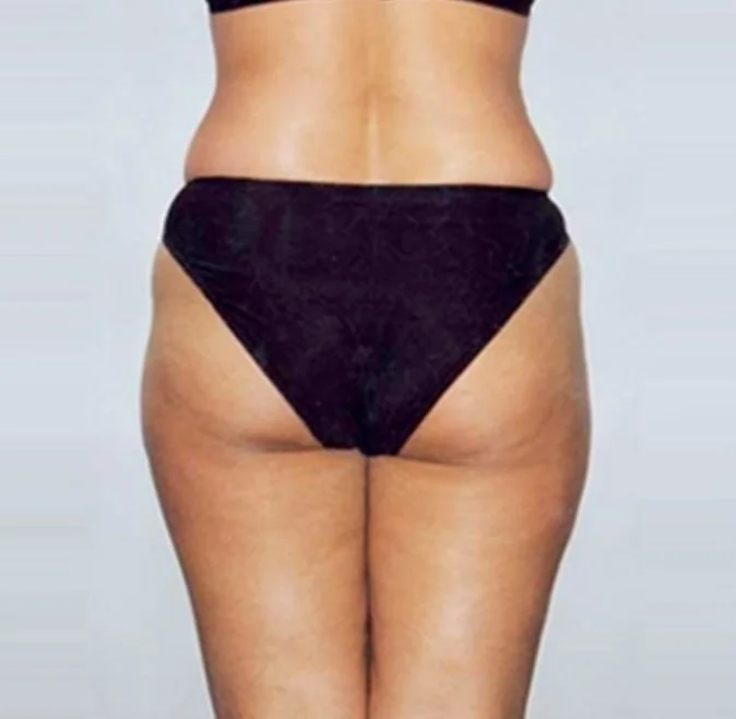 lymphatic drainage- the lymph lounge 6.jpg