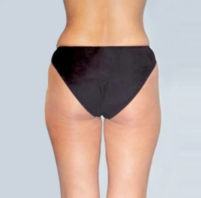 lymphatic drainage- the lymph lounge 5.jpg