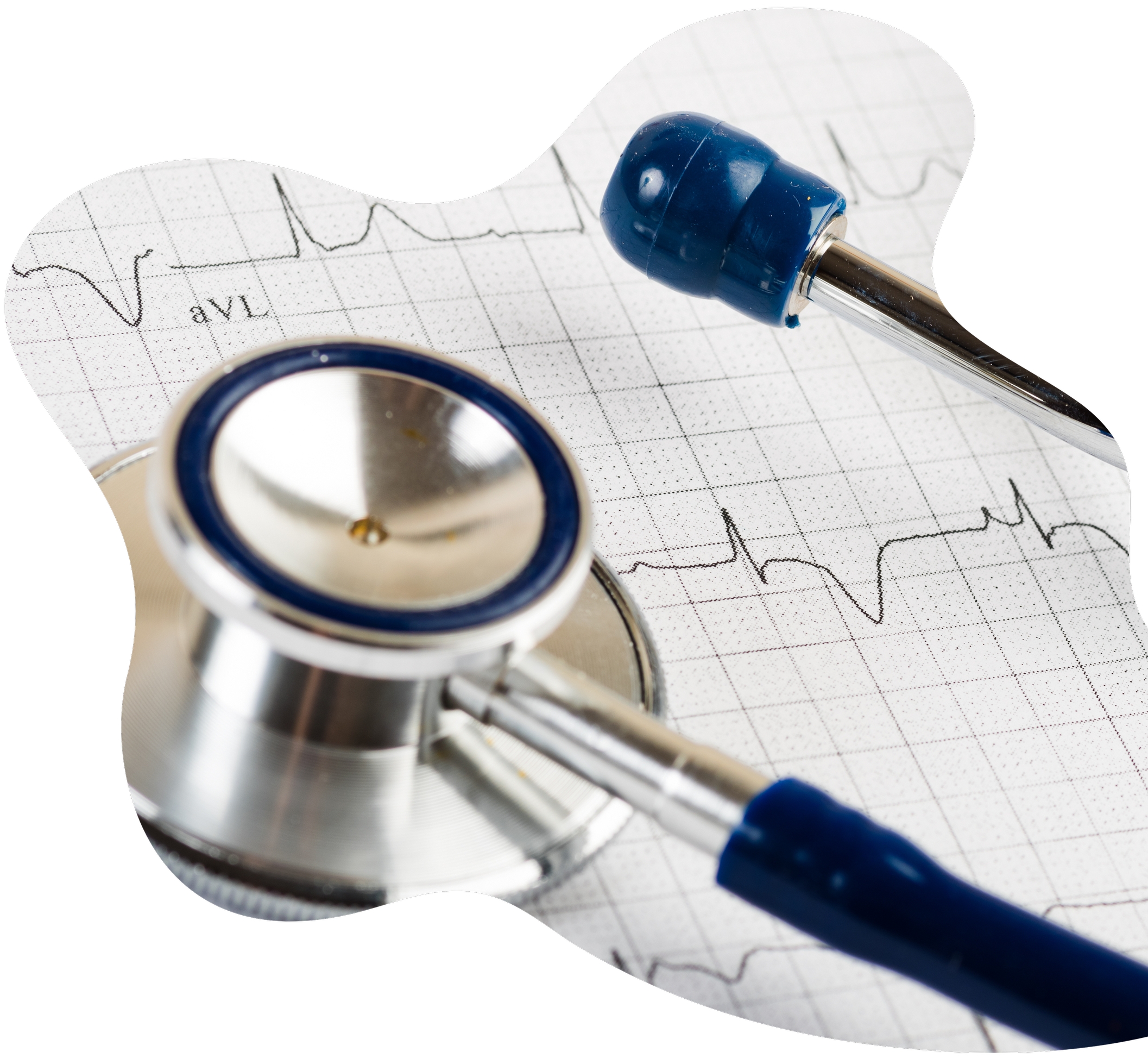 Stethoscope and blood pressure cuff on an electrocardiogram paper.