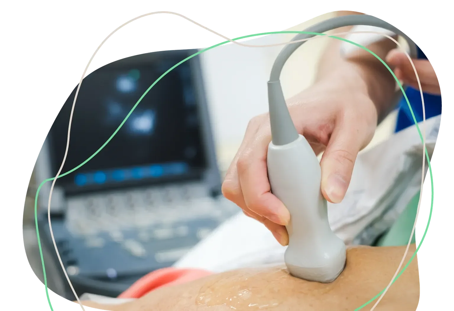 Diagnostic ultrasound procedure performed by a medical professional in a modern healthcare facility