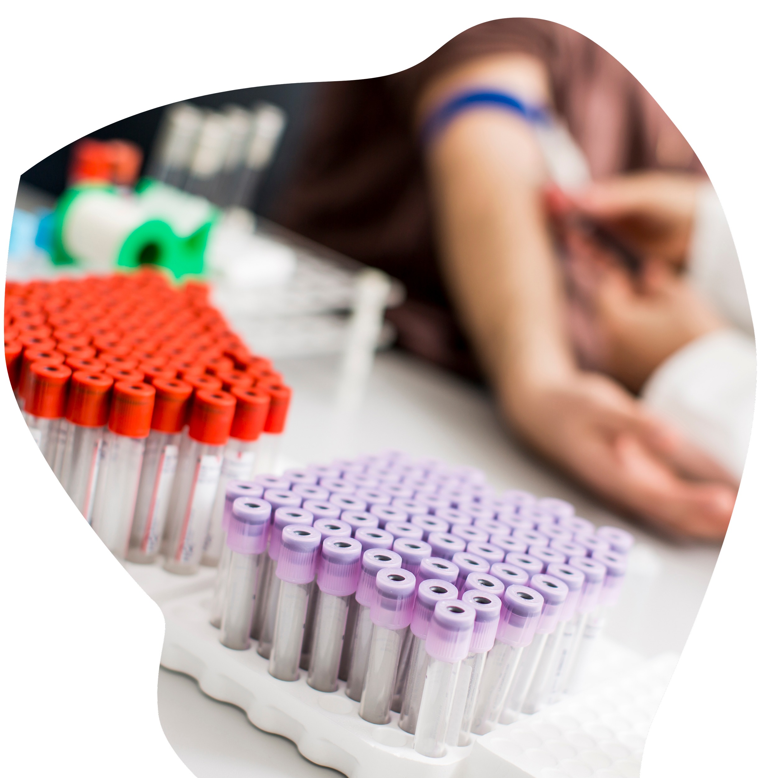 Close-up of blood collection tubes with purple caps, arranged in a rack.