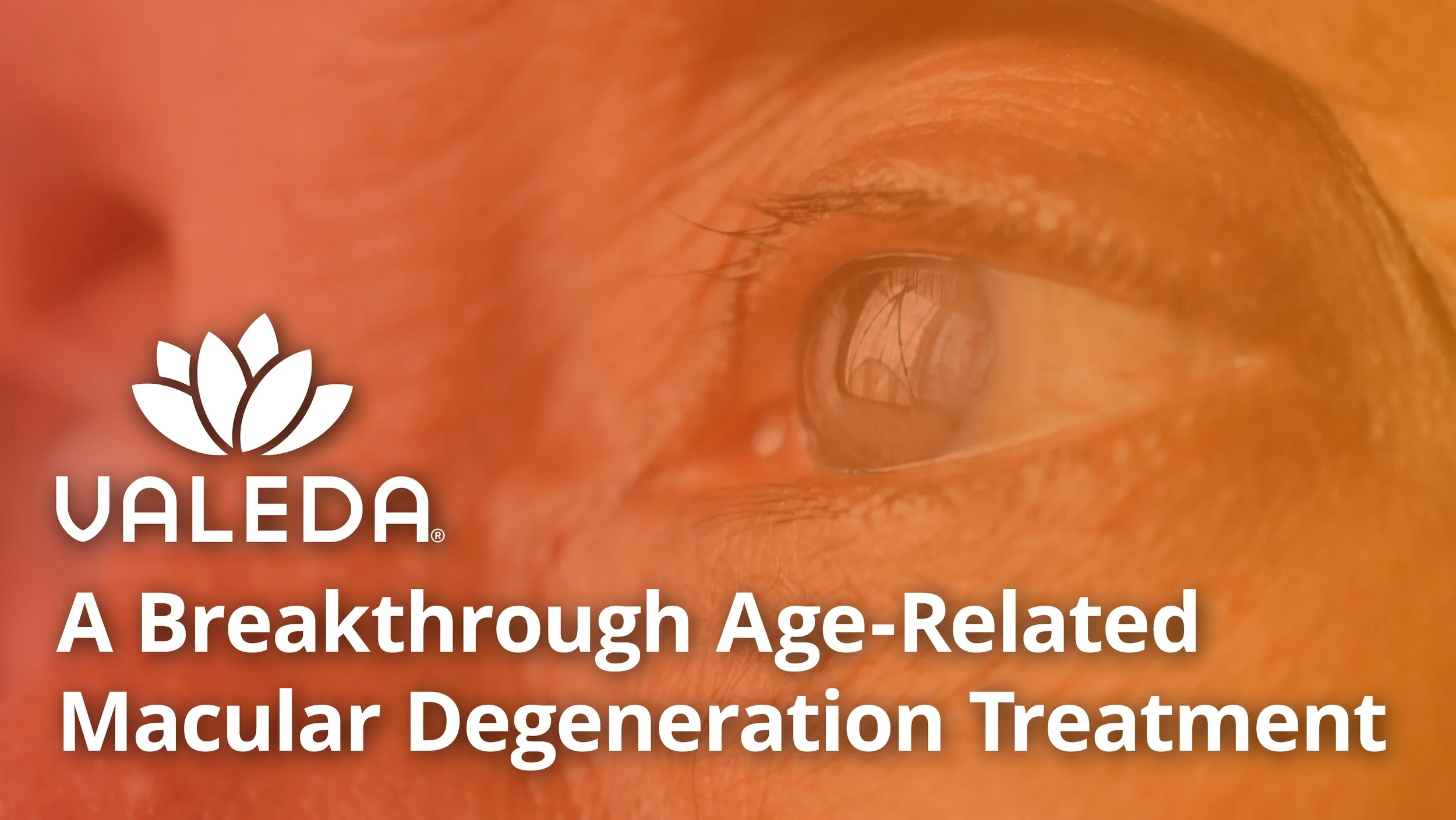 Introducing Valeda® Red Light Therapy: A Breakthrough in Vision Care