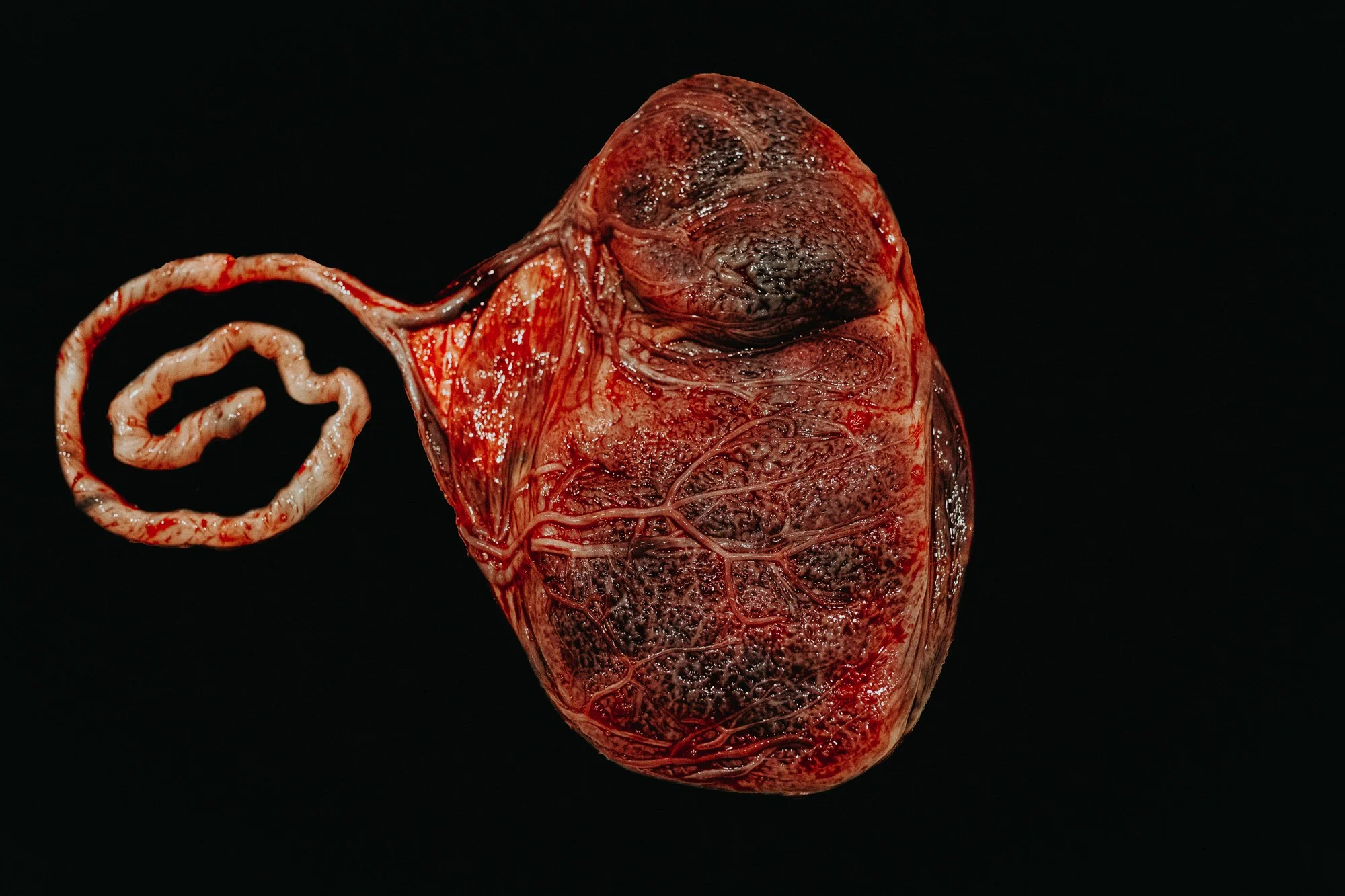 The Wonders of the Placenta