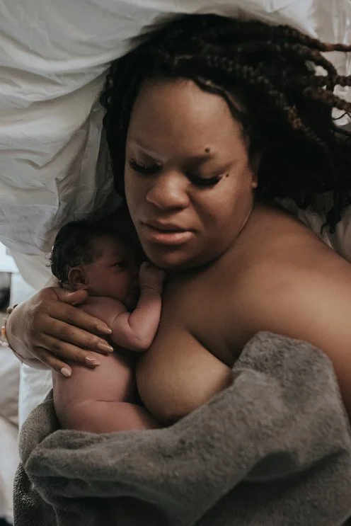Birth Photography After a Cesarean