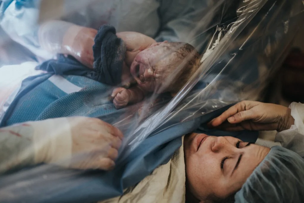 Beautiful Shameless Cesarean Birth