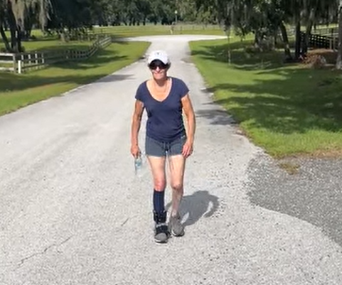 Baby Steps: Learning to Walk Again After an Ankle Surgery