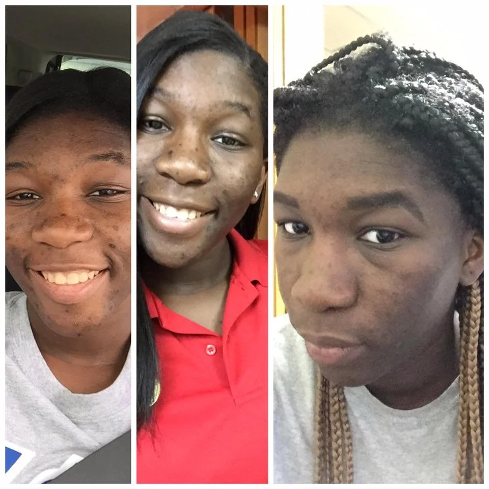 8/19-My Skin Story, Pt 1