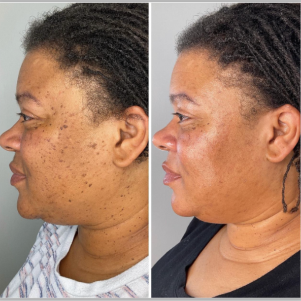 Image Courtesy of BeautyEQ