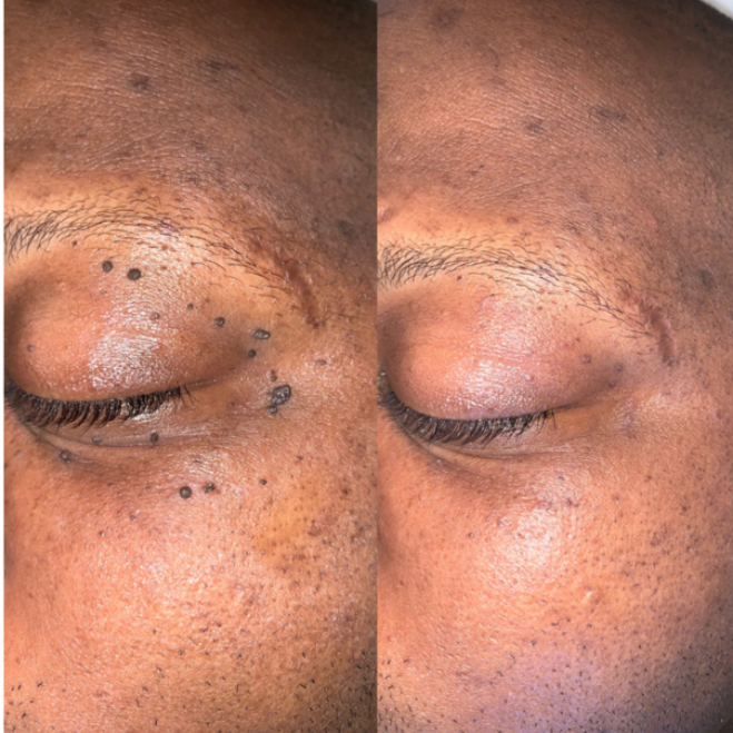 Image Courtesy of BeautyEQ