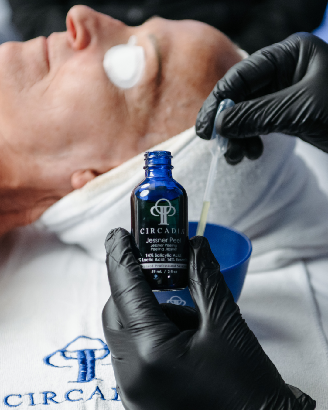 A person receiving a facial peel treatment with a bottle labeled 'Circadia Jessner Peel' held by a hand in black gloves, and a person lying down with a towel around their neck.