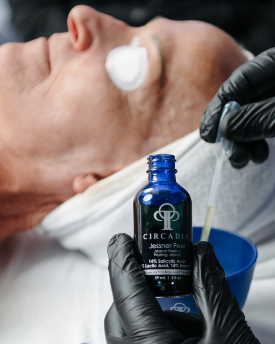 A person lying down with a cotton pad on their cheek, receiving a facial treatment chemical peel. Esthetician in black gloves holds a dropper above a blue bottle labeled 'Circadia Jessner Peel' containing a peel solution.