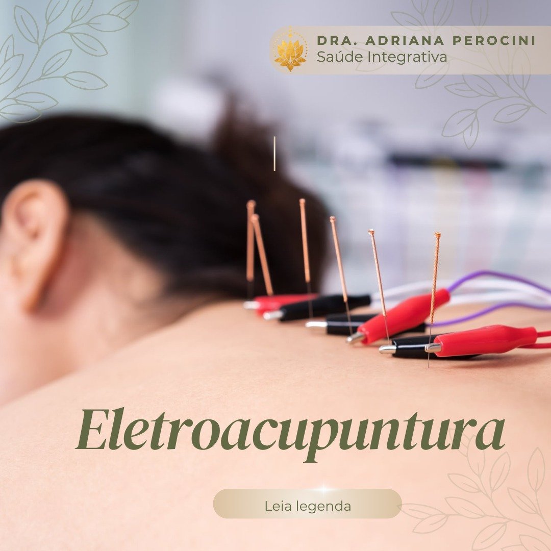 A eletroacupuntura &eacute; muito utilizada hoje, principalmente para tratamento de dores cr&ocirc;nicas. 
Os eletrodos s&atilde;o fixados nas agulhas. &Eacute; um recurso valioso, pois traz &oacute;timos resultados. 
☑ Indica&ccedil;&otilde;es: Dore