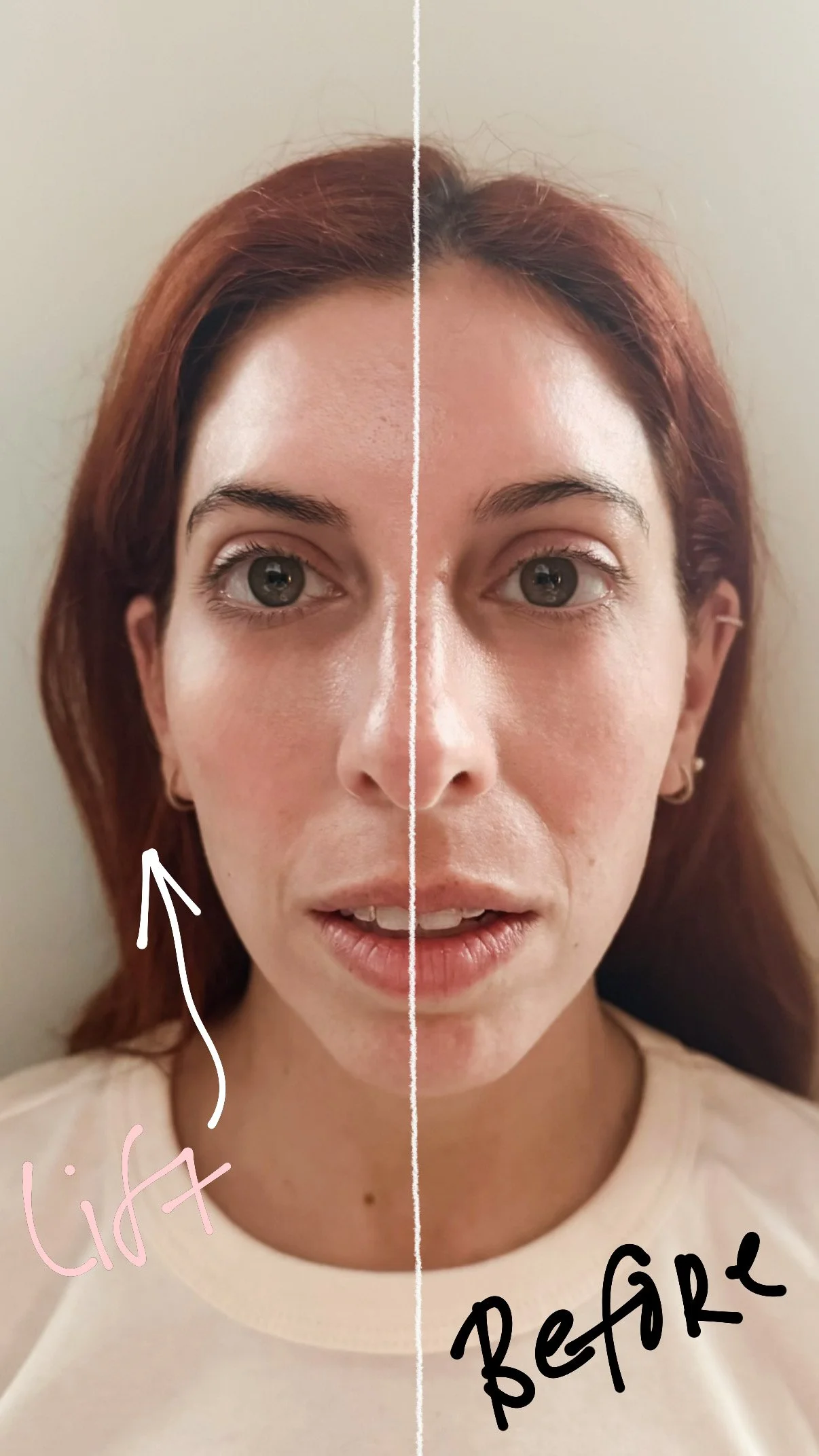 Split image showing a woman with clear skin and minimal makeup labeled 'Lift' on the left side and 'Before' on the right side.