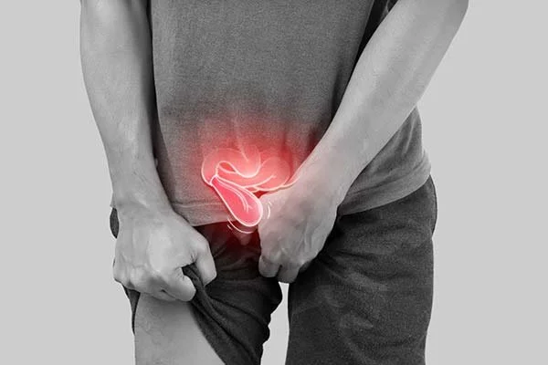 Can an Inguinal Hernia Come Back After Surgery?