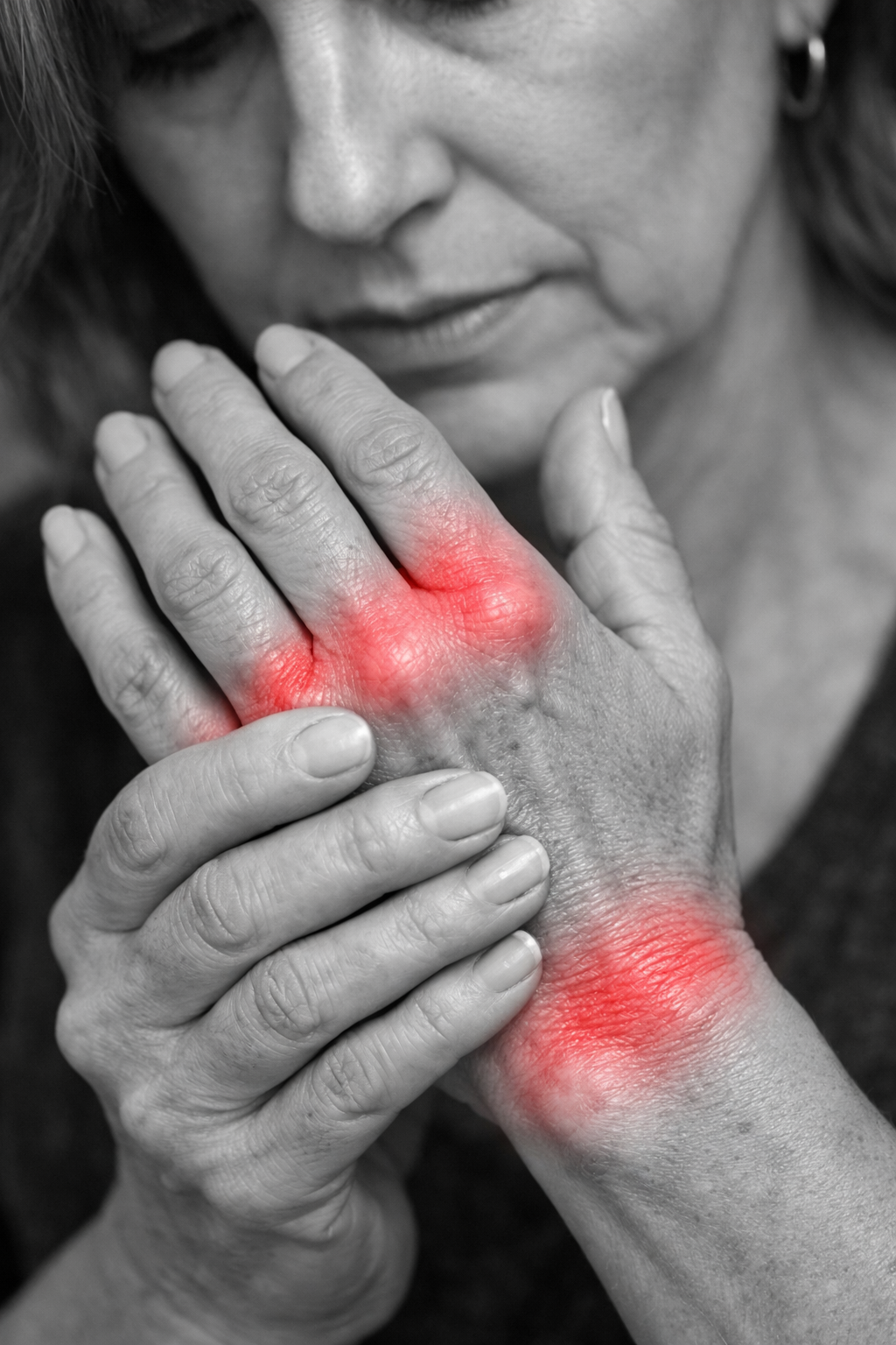 Black and white close-up photograph of a woman’s hands and wrists with subtle red highlighting over the wrist and MCP joints, illustrating rheumatoid arthritis inflammation