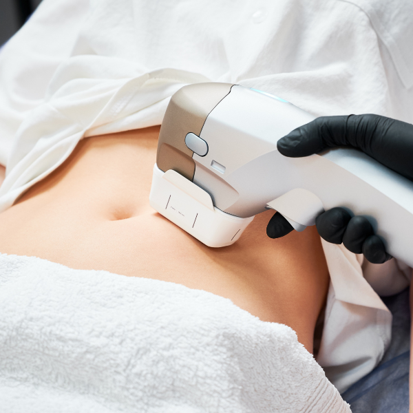 HIfu body treatment 