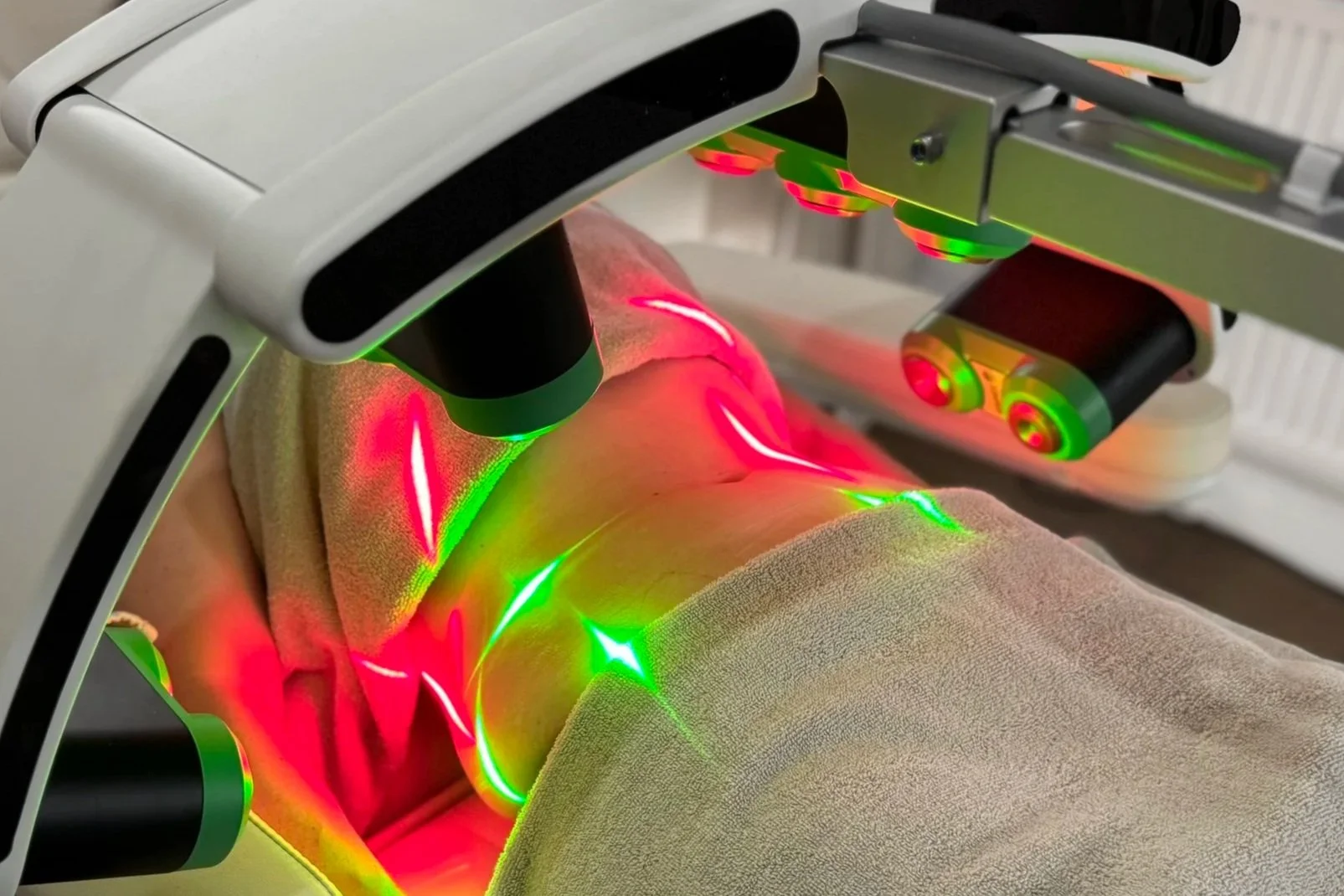 Treatment of the body contour low level laser light therapy 