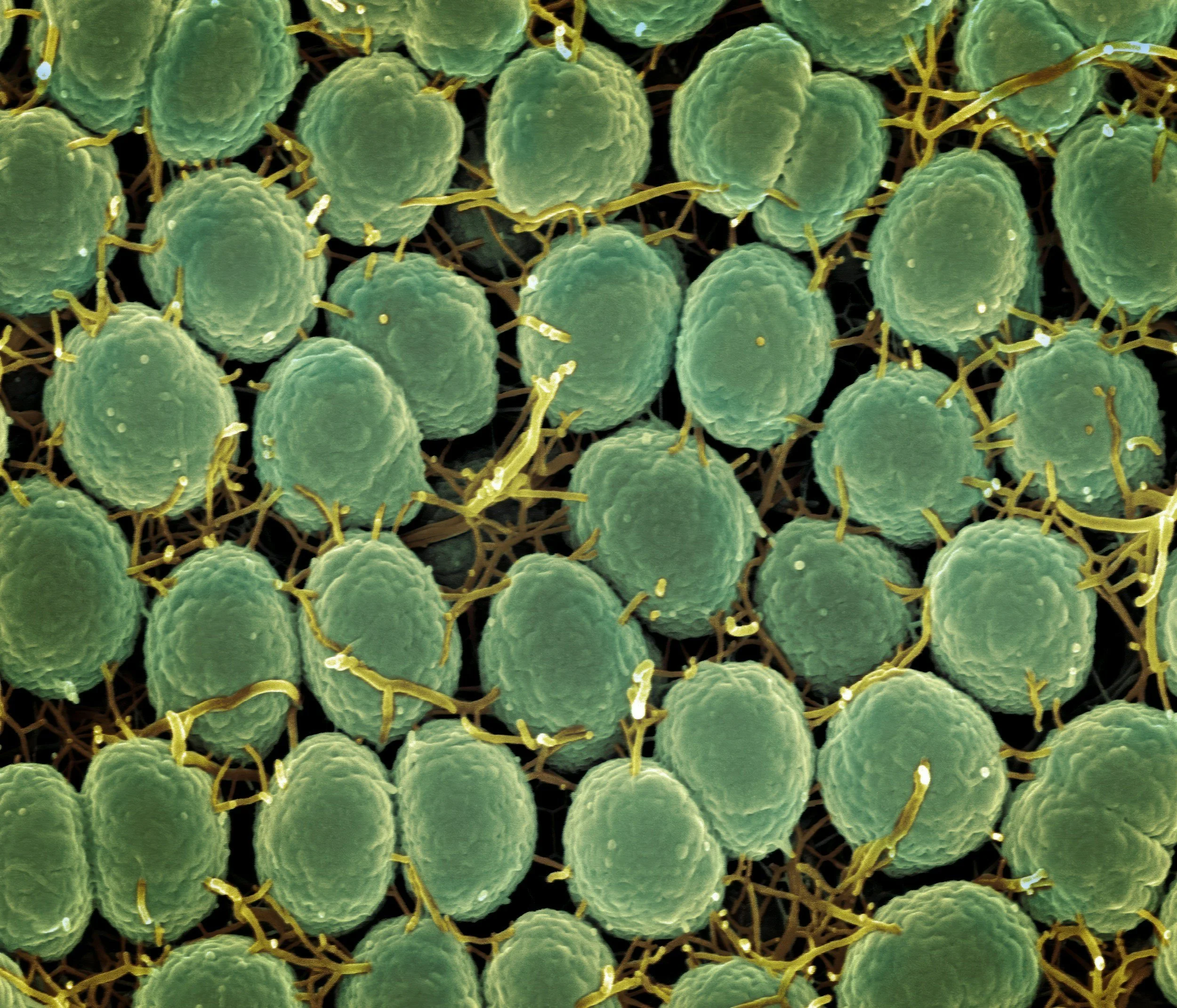 5 Signs Your Hormones Are Out of Balance, and How Your Gut Could Be to Blame