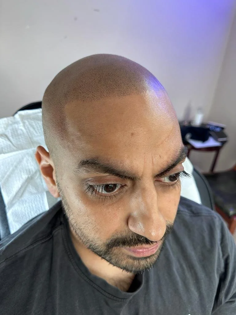 Man with a freshly shaved bald head, dark beard, and eyebrows, sitting on a chair.