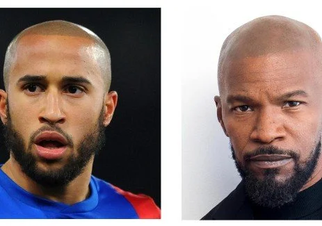 Why is SMP            Scalp Micropigmentation trending?