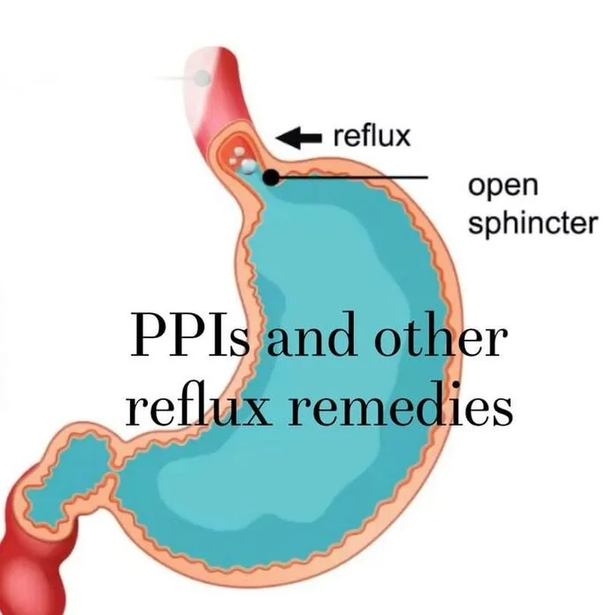 Understanding the Link Between Reflux and Bronchiectasis