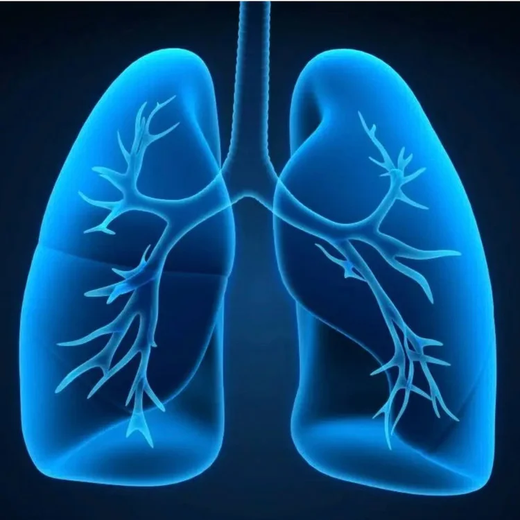 Neutrophils, Apoptosis, and Why This Matters in Bronchiectasis