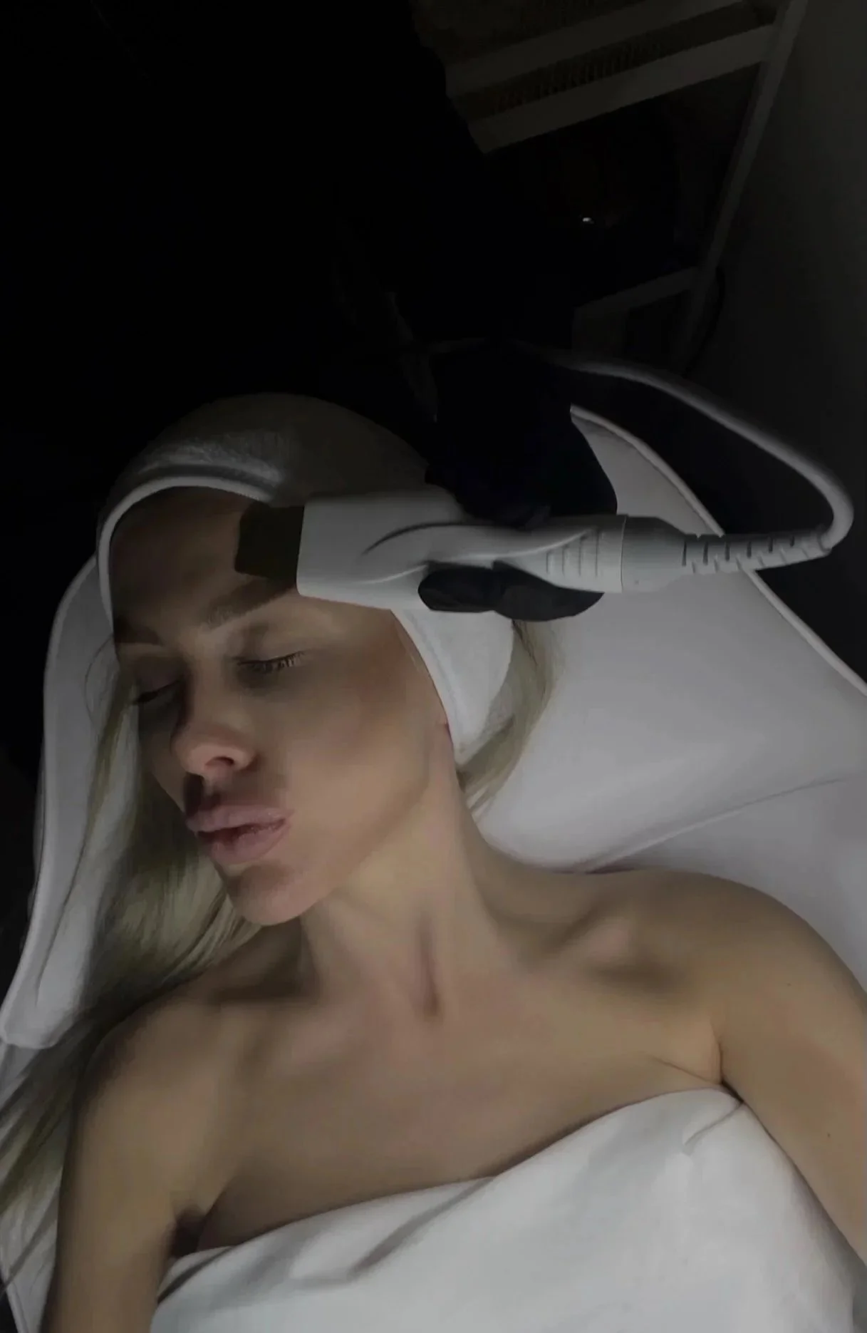 A woman lying on a medical bed during a cosmetic treatment, with a medical device applying treatment to her face.