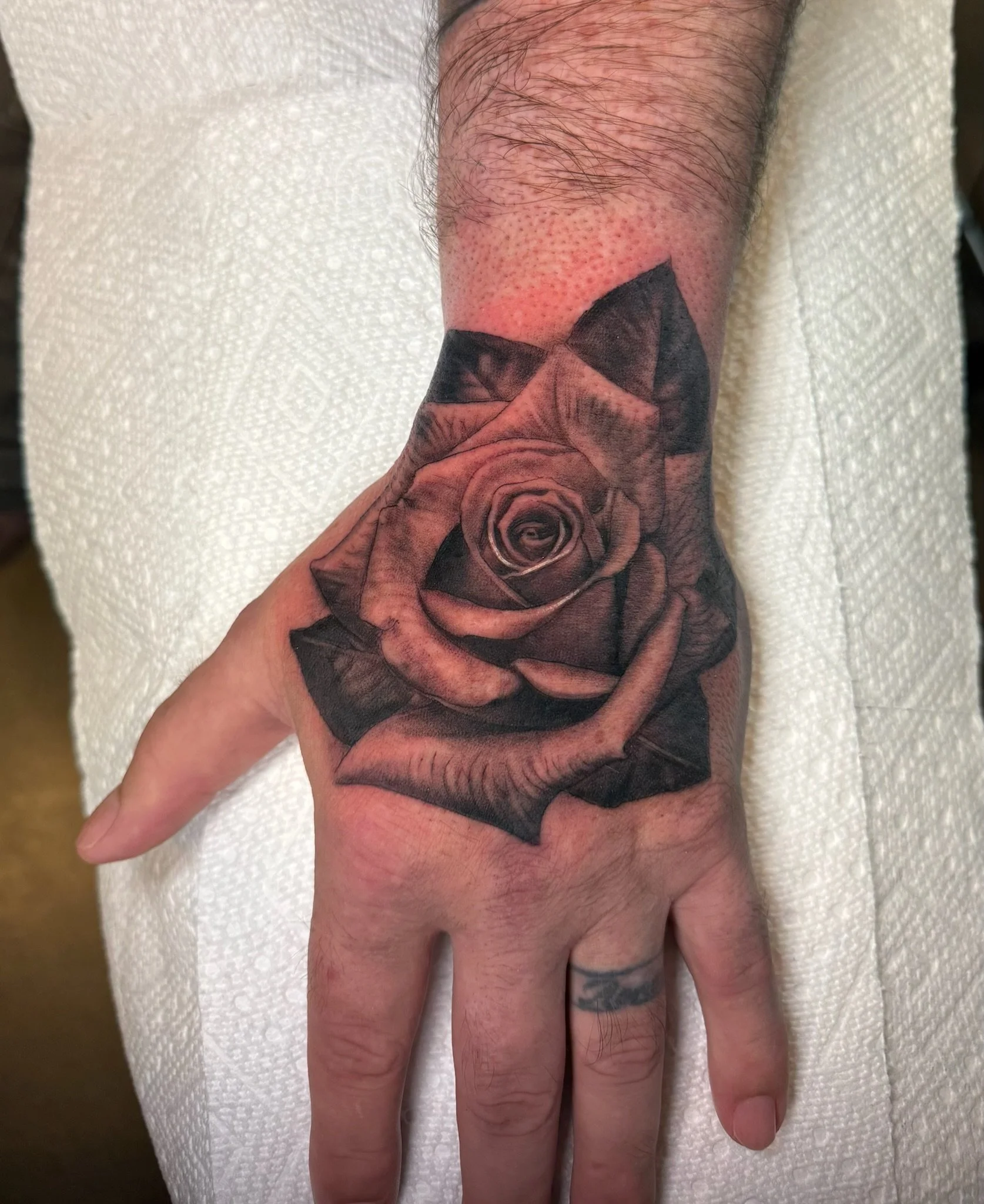 Close-up of a person's hand and wrist with a large black tattoo of a rose on the lower arm, and a red, irritated bruise or rash around the tattoo area.