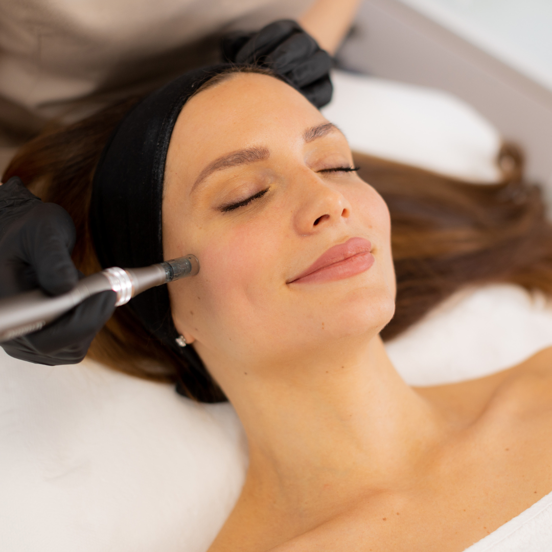 Medspa in Monroeville, PA 15146 l Microneedling PDRN Near Me