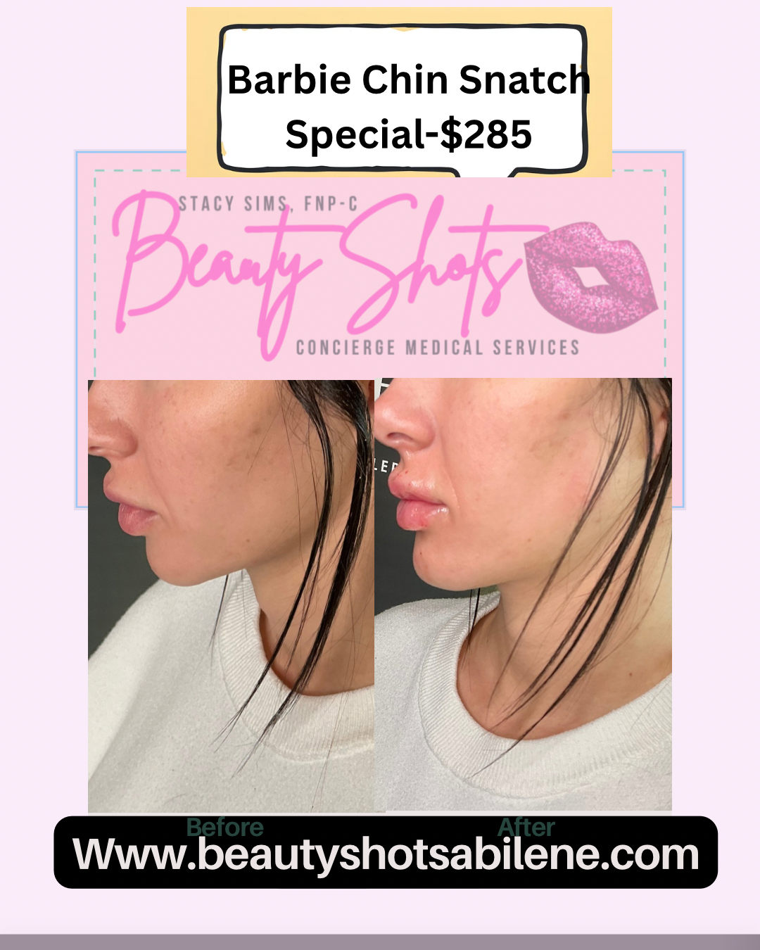Beige Minimalist Bold Beauty Skincare Before After Collage Instagram Post copy.png