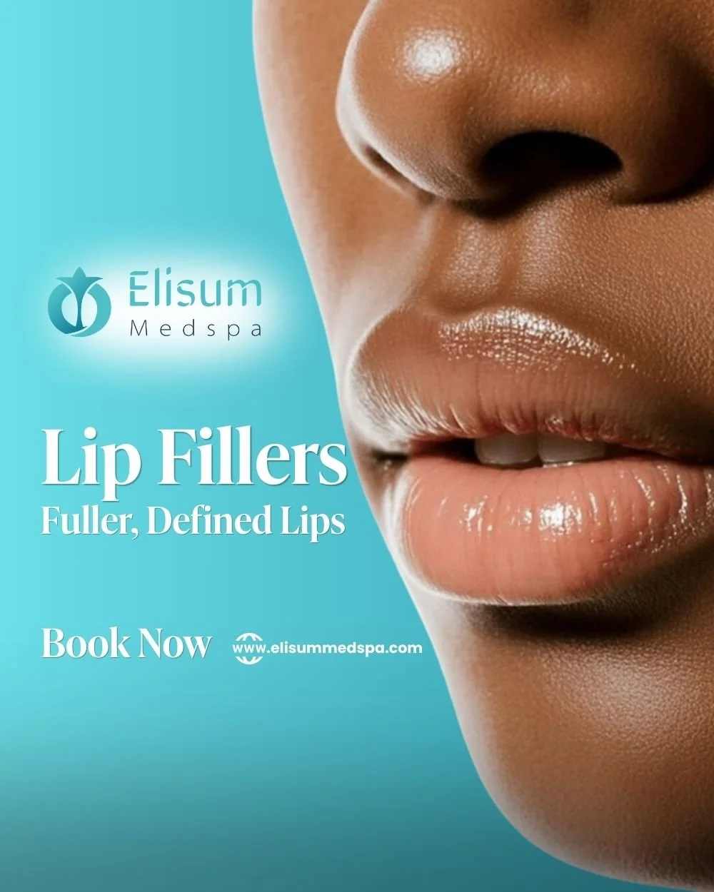 Lip Fillers in Frisco, TX | Fuller, Defined Lips