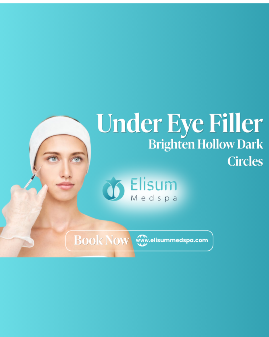 Under Eye Filler in Frisco, TX – Brighten Hollow Dark Circles