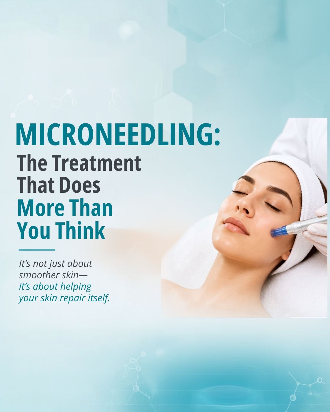 Microneedling Treatment in Frisco, TX: The Treatment That Does More Than You Think