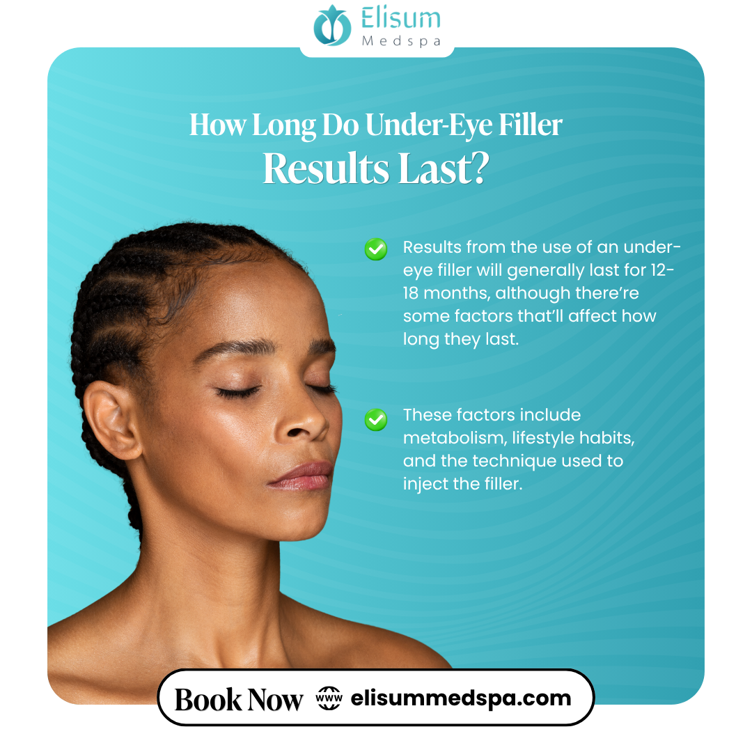 How Long Do Under-Eye Filler Results Last?