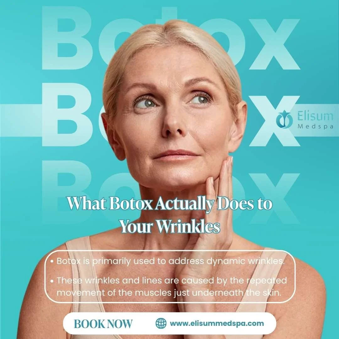 What Botox Actually Does to Your Wrinkles 